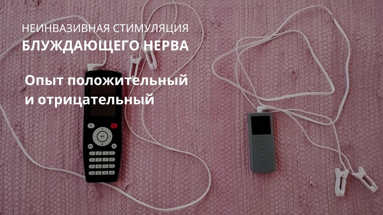 Опыт стимуляции блуждающего нерва, позитивный и негативный