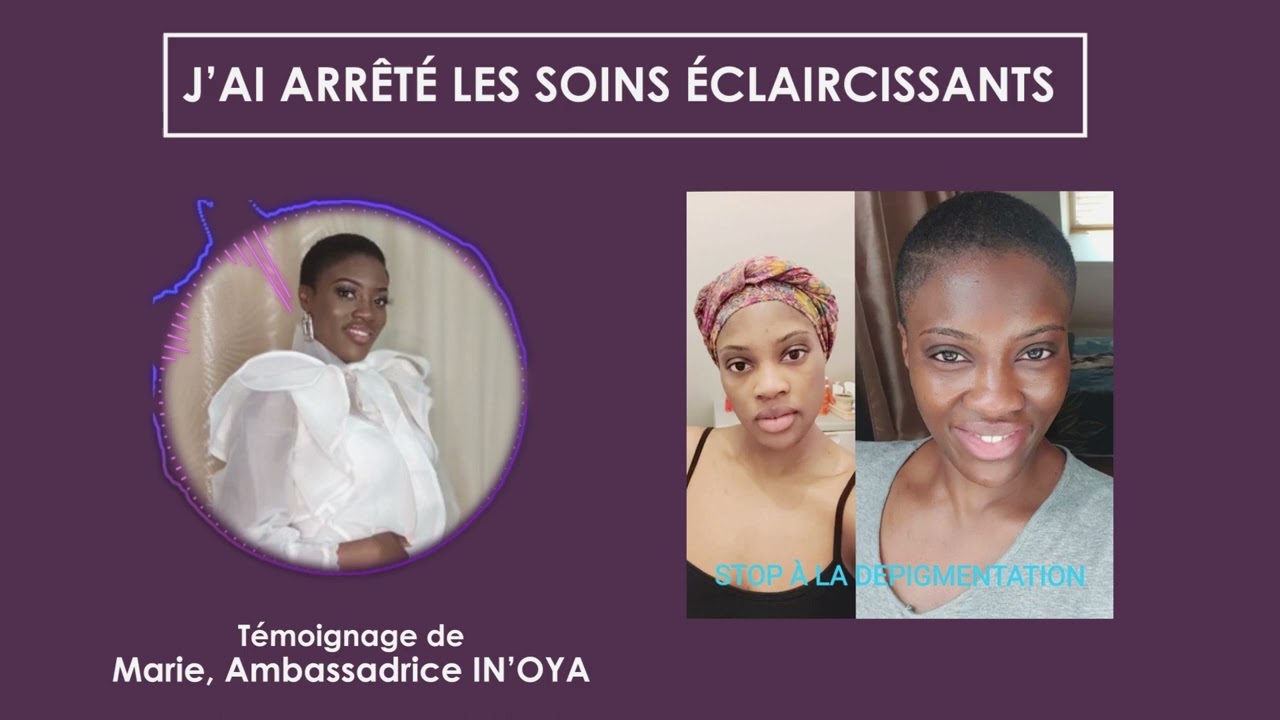J'ai enfin réussi à arrêter les soins éclaircissants ! - Témoignage de Marie