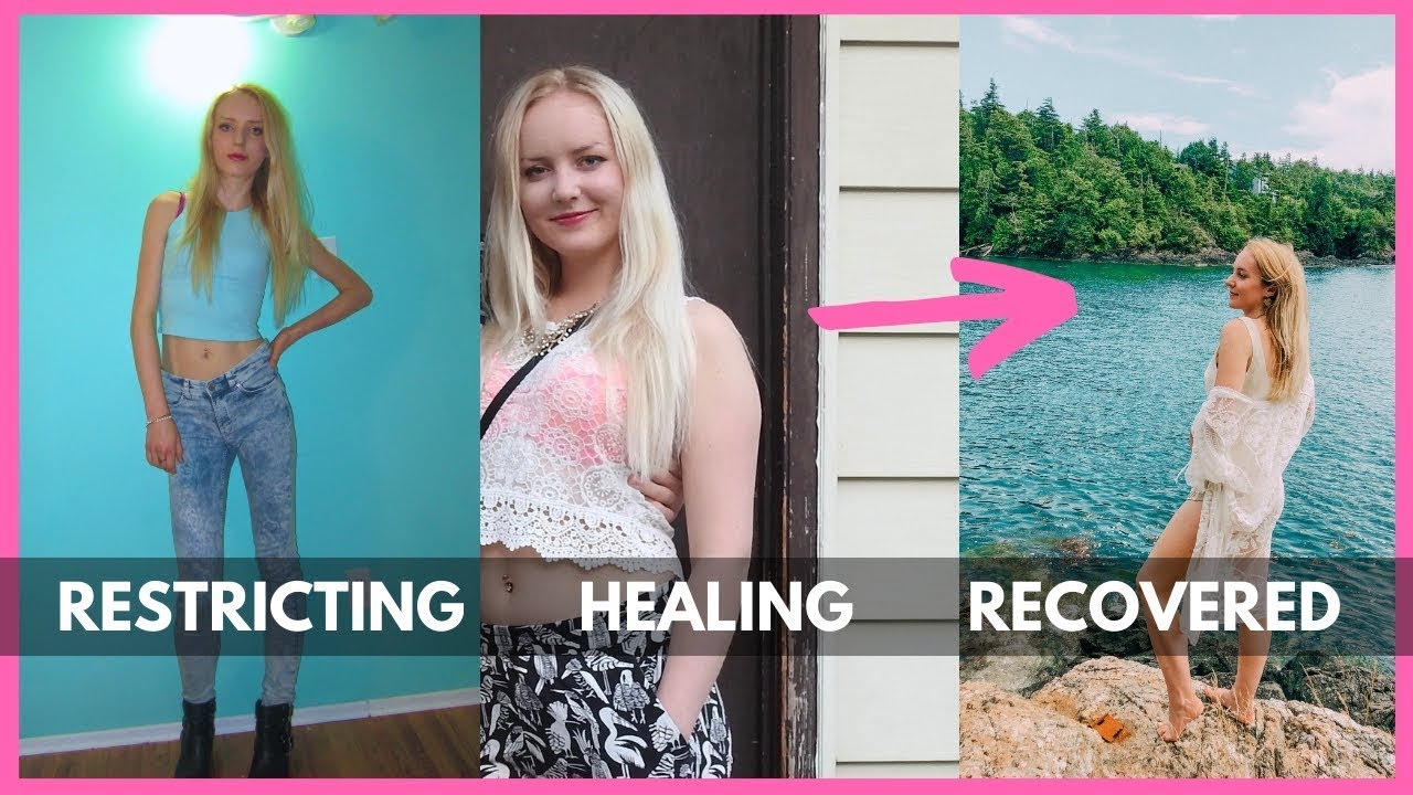 FIRST I’ll lose weight, THEN I’ll be healthy??