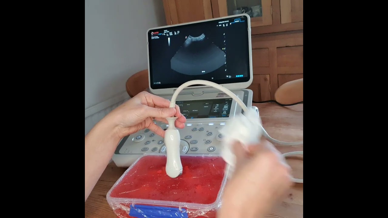 Ultrasound-guided aspiration