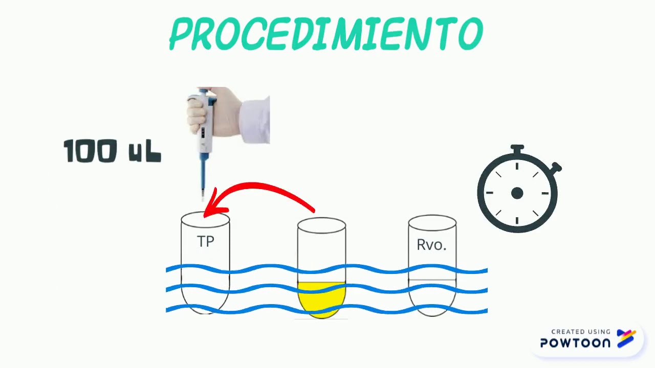 Tiempo de Protrombina