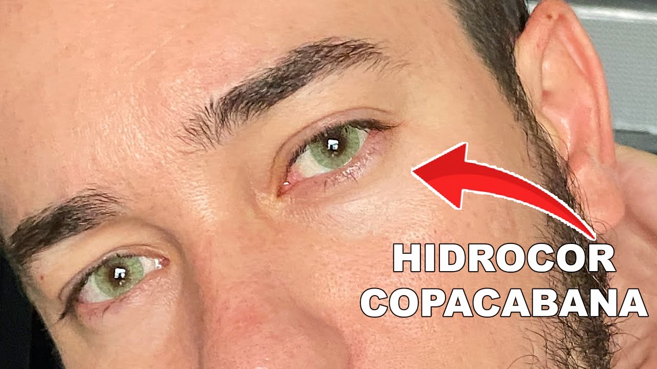 OLHO VERDE | SOLÓTICA HIDROCOR COPACABANA