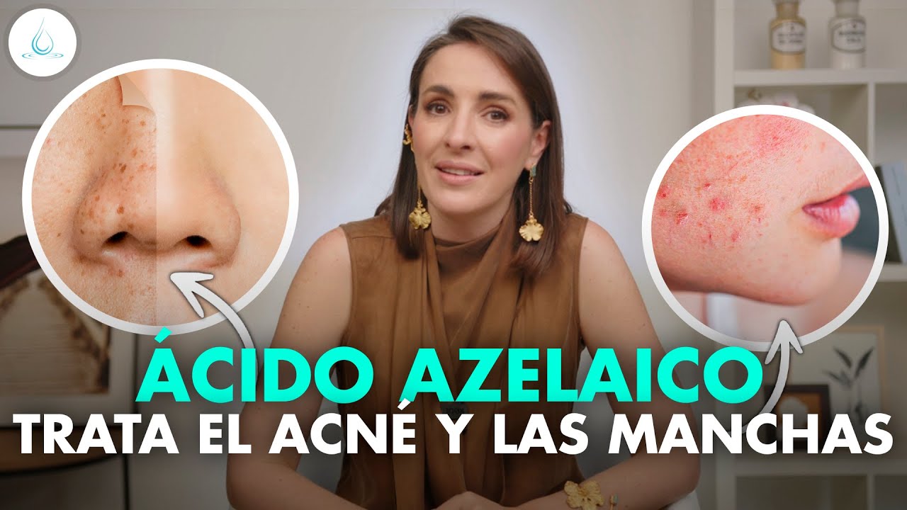 🔴 MILAGROSO ACIDO AZELAICO ¡NO MÁS MANCHAS, ROSACEA y ACNÉ! @drapilarochoa - Dermatologa