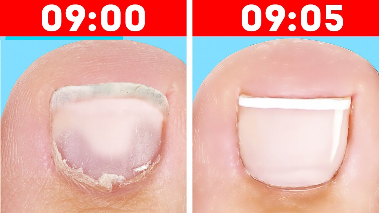 TRUCCHI VELOCI PER FARE LA PEDICURE E PER I PIEDI CHE DEVI CONOSCERE!