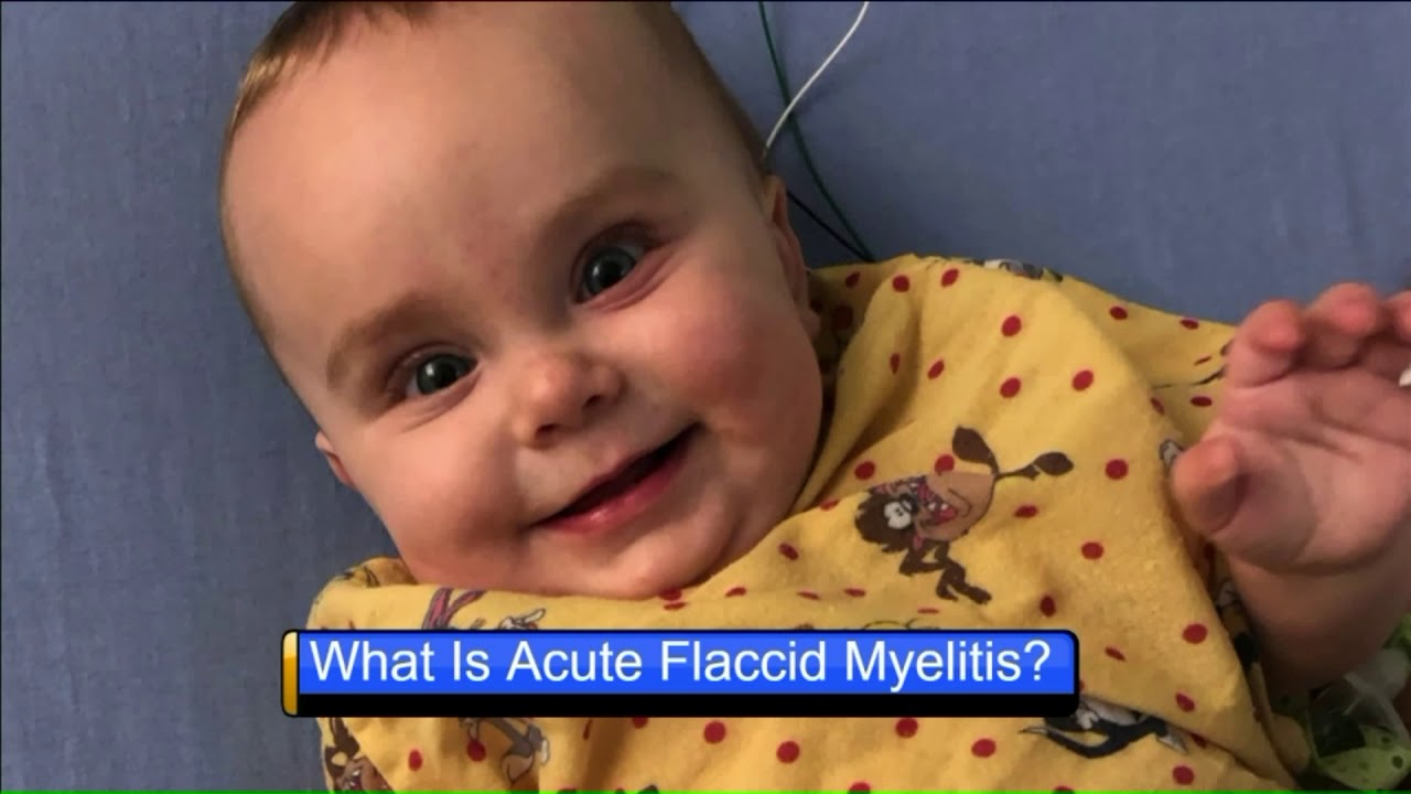 What is Acute Flaccid Myelitis?