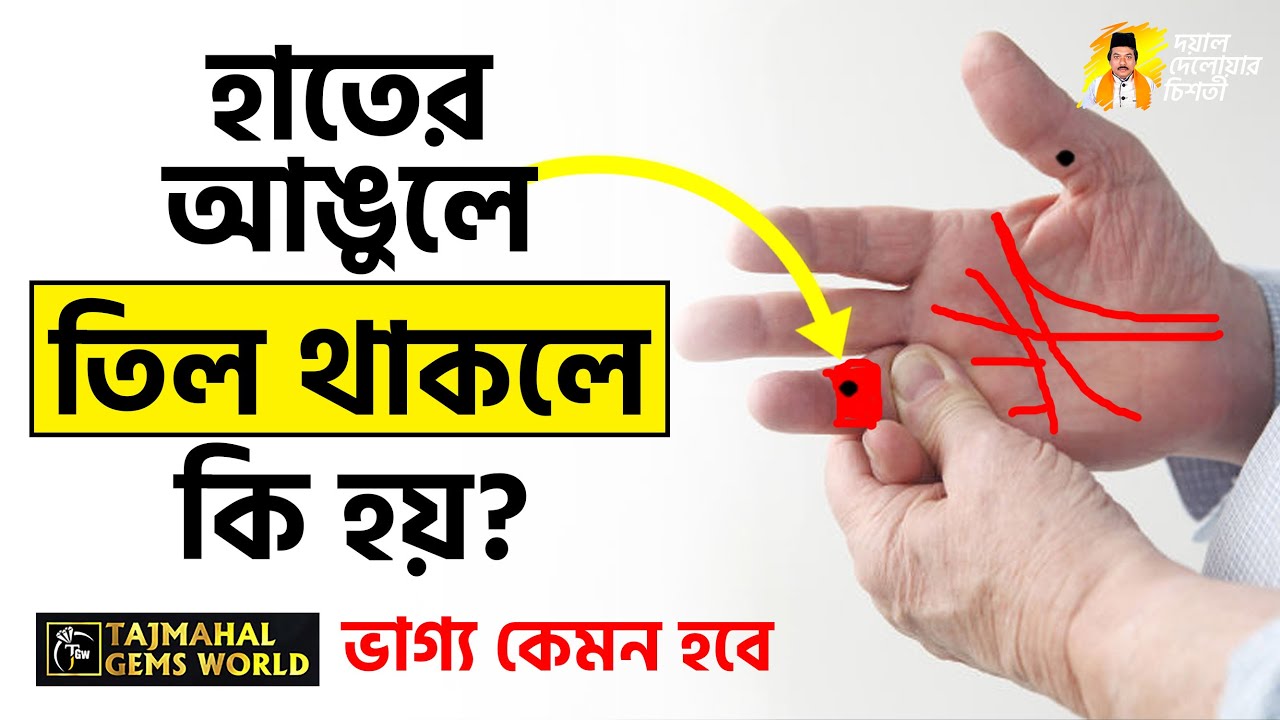 হাতের আঙুলে তিল থাকলে ভাগ্য কেমন হবে  Hater Angule Til Thakle Ki Hoy