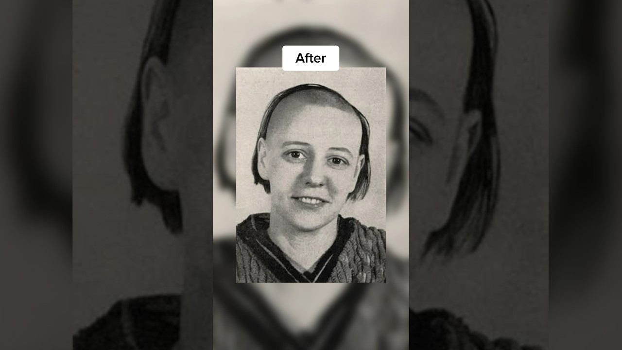 People before and after lobotomy..😰💀 #Shorts