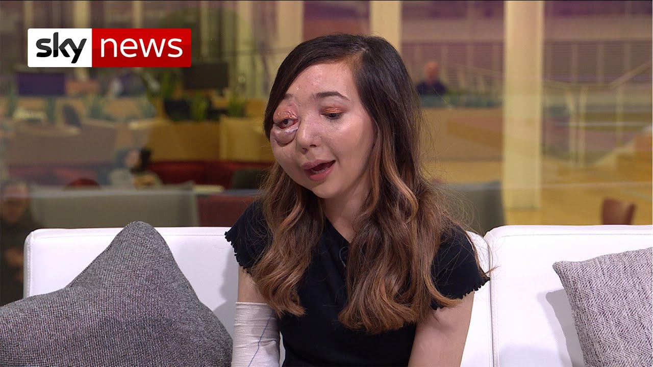 Nikki Lilly: 'I was really surprised all the comments were positive'