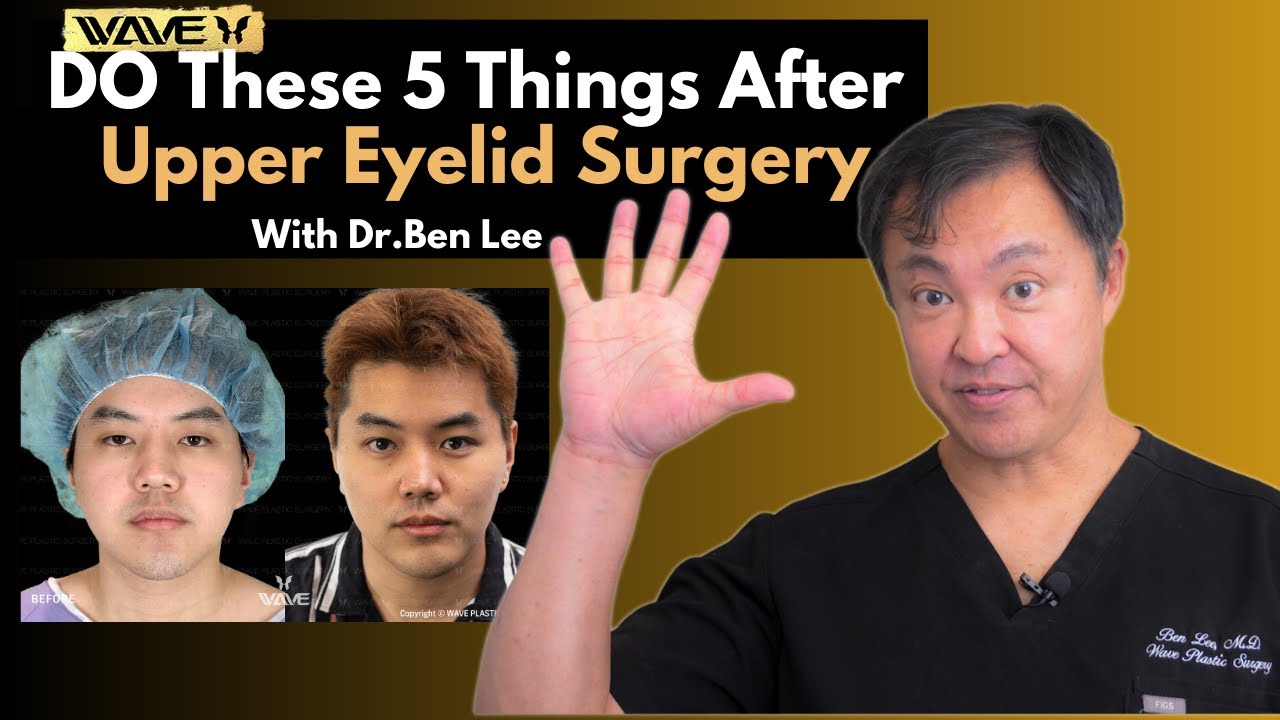 5 Do's and Don'ts During Your Upper Eyelid Surgery Recovery