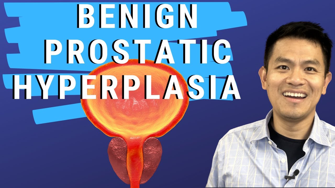 Basics of Enlarged Prostate Treatments | Benign Prostatic Hyperplasia