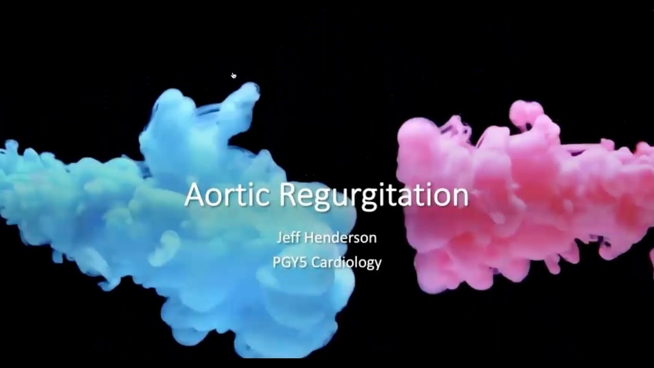 Echocardiographic Evaluation of Aortic Regurgitation