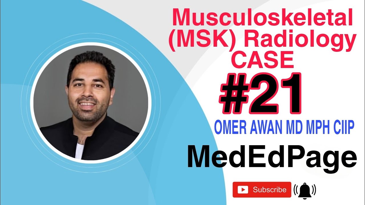 Musculoskeletal (MSK) Radiology CASE #21