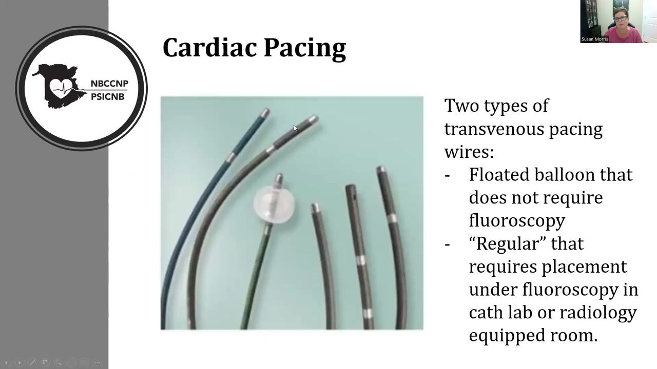 Quick Review of VVI pacing for NBCCNP students