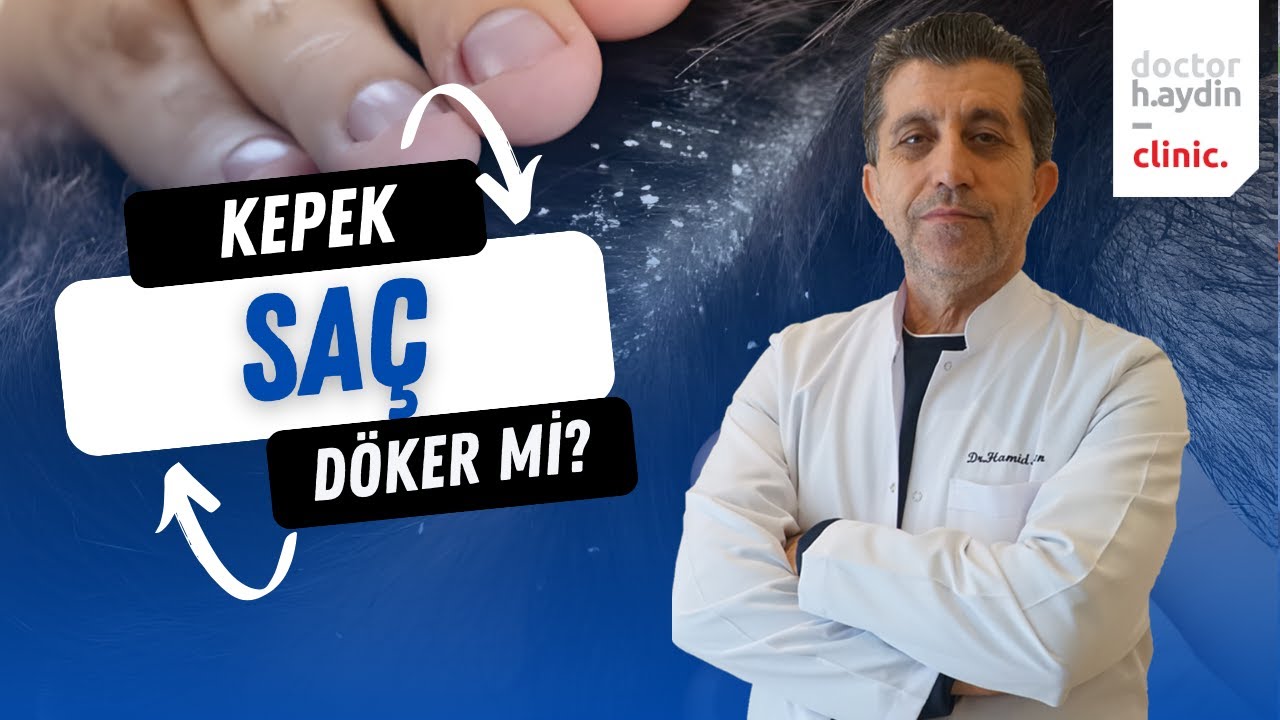 Kepek Saç Döker mi? - Dr. Hamid AYDIN