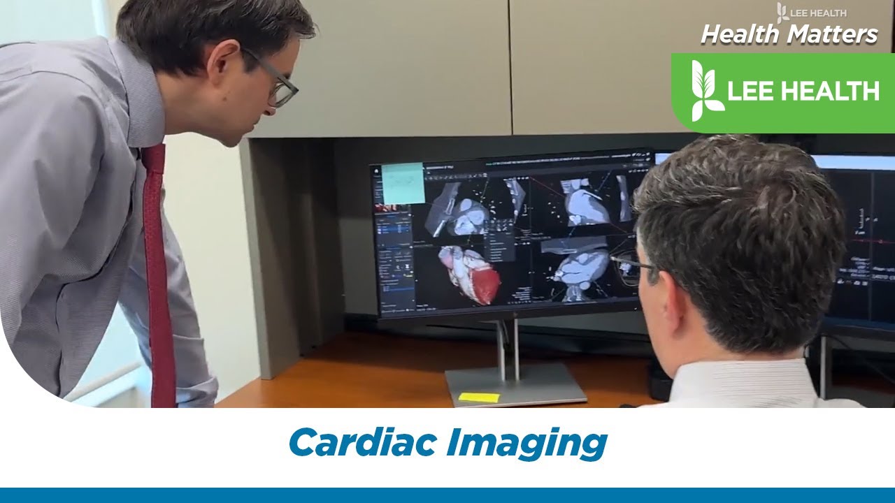 Cardiac Imaging