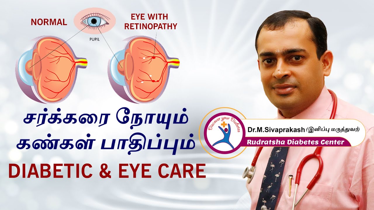Diabetes and Eye Care | சர்க்கரை நோயும், கண் பார்வையும்: தெரிந்துக் கொள்ள வேண்டியவை, செய்ய கூடாதவை!