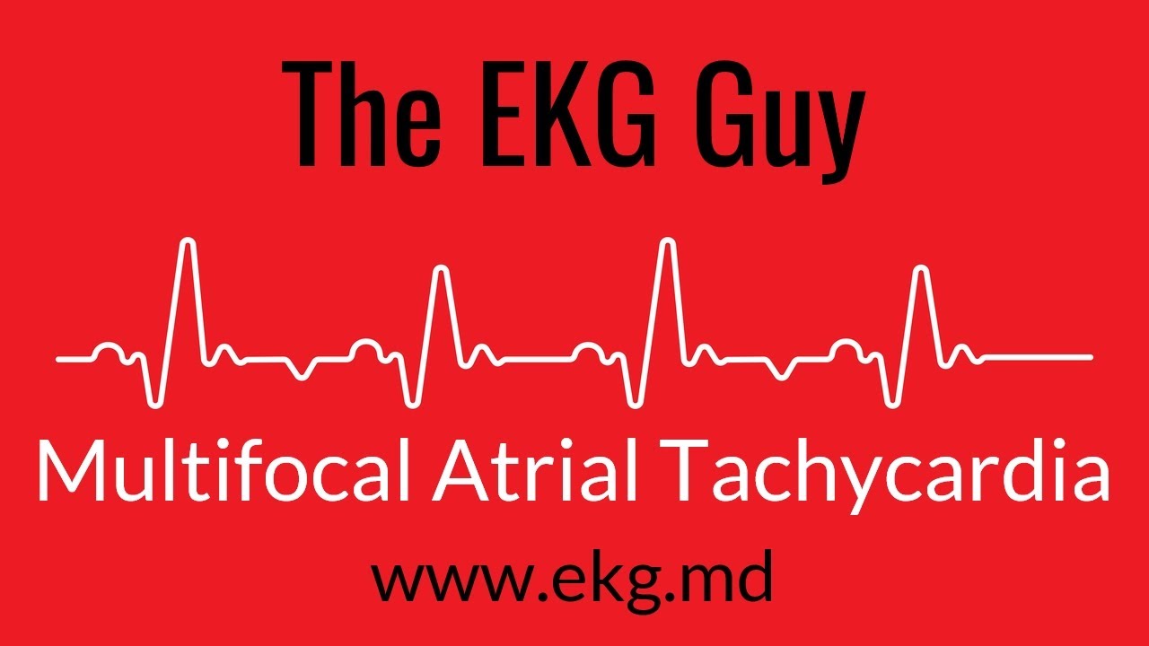Мультифокальная предсердная тахикардия ЭКГ l The EKG Guy - www.ekg.md
