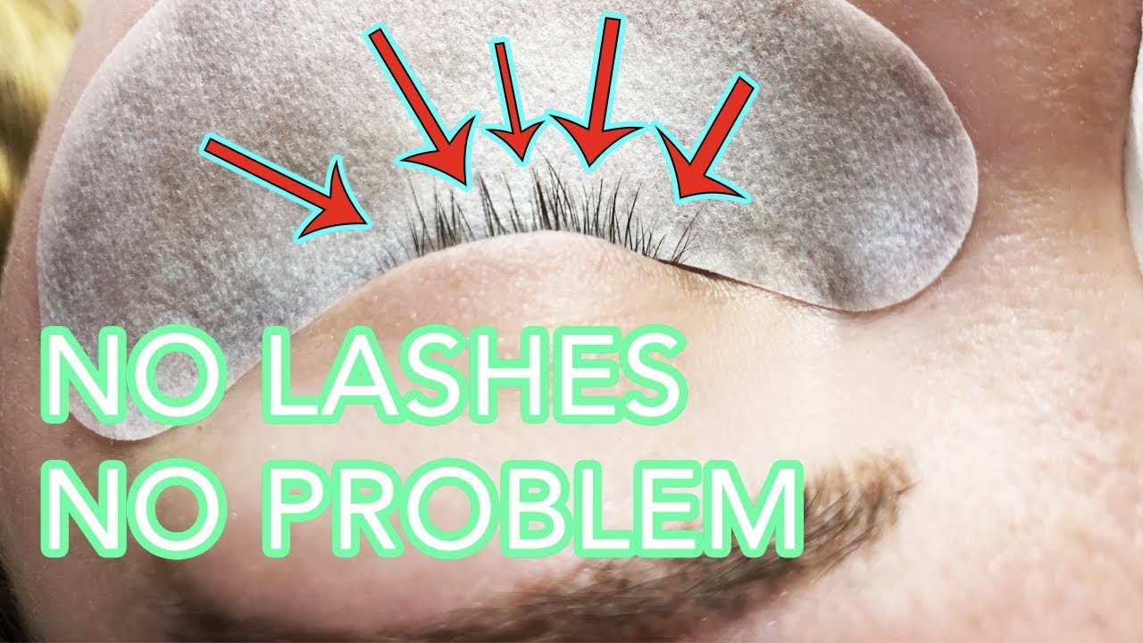 EYELASH EXTENSIONS FOR HAIR PULLING TRICHOTILLOMANIA USING VOLUME LASHES