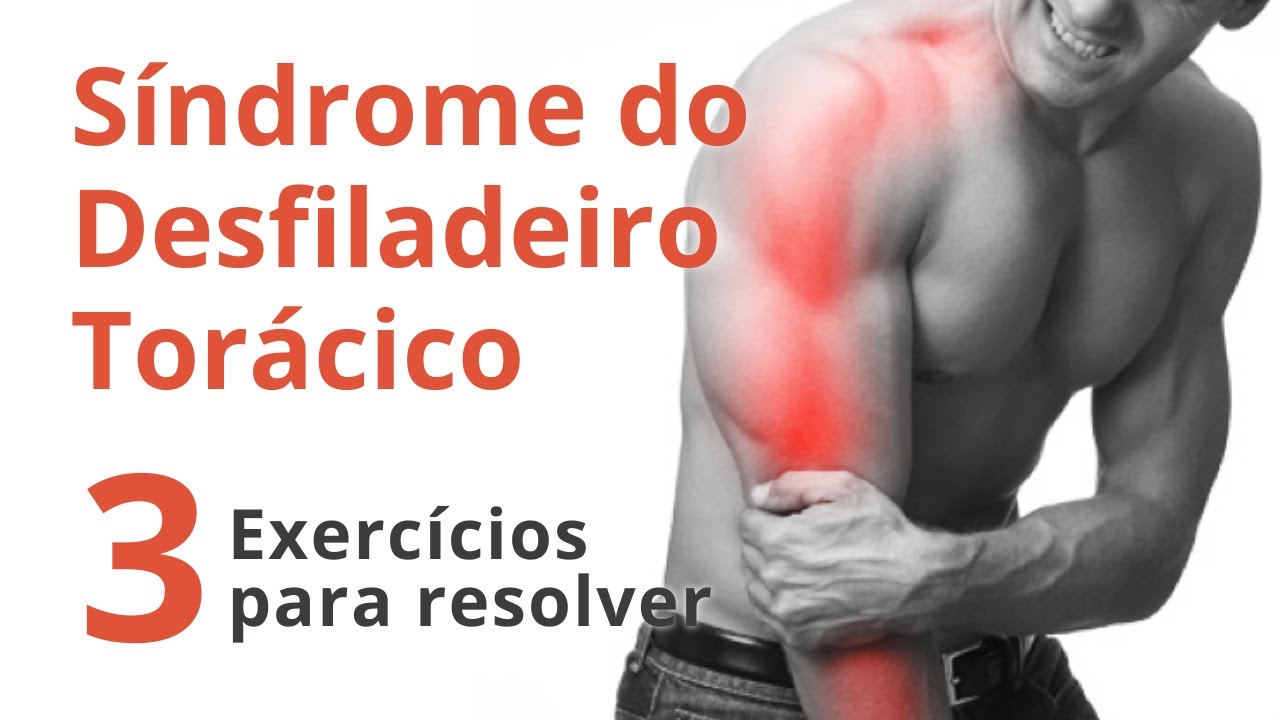 Síndrome do Desfiladeiro Torácico - Dor, formigamento, perda de força do ombro até a mão