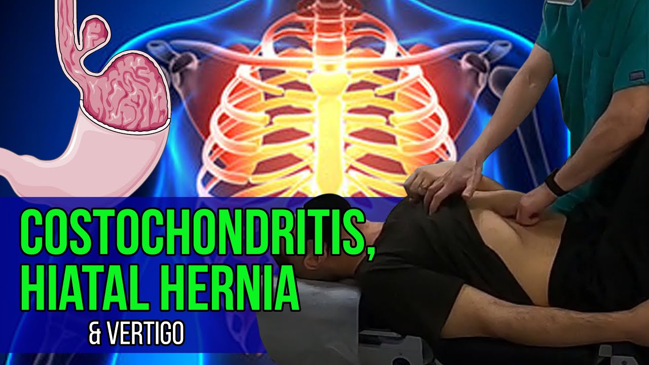 Костохондрит, грыжа пищеводного отверстия диафрагмы и головокружение | Synergy Wellness | Хиропра...