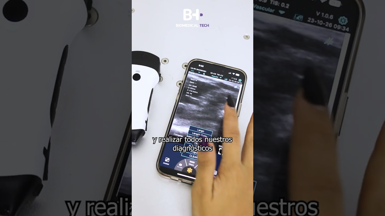 Esto es lo que puedes hacer con la sonda de ultrasonido KONTED C10RL
