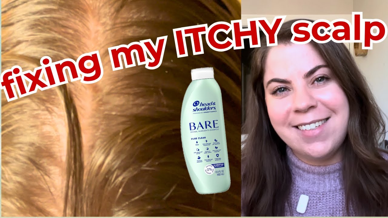 I Fixed My Itchy Scalp Using LabMuffinBeauty&rsquo;s Routine