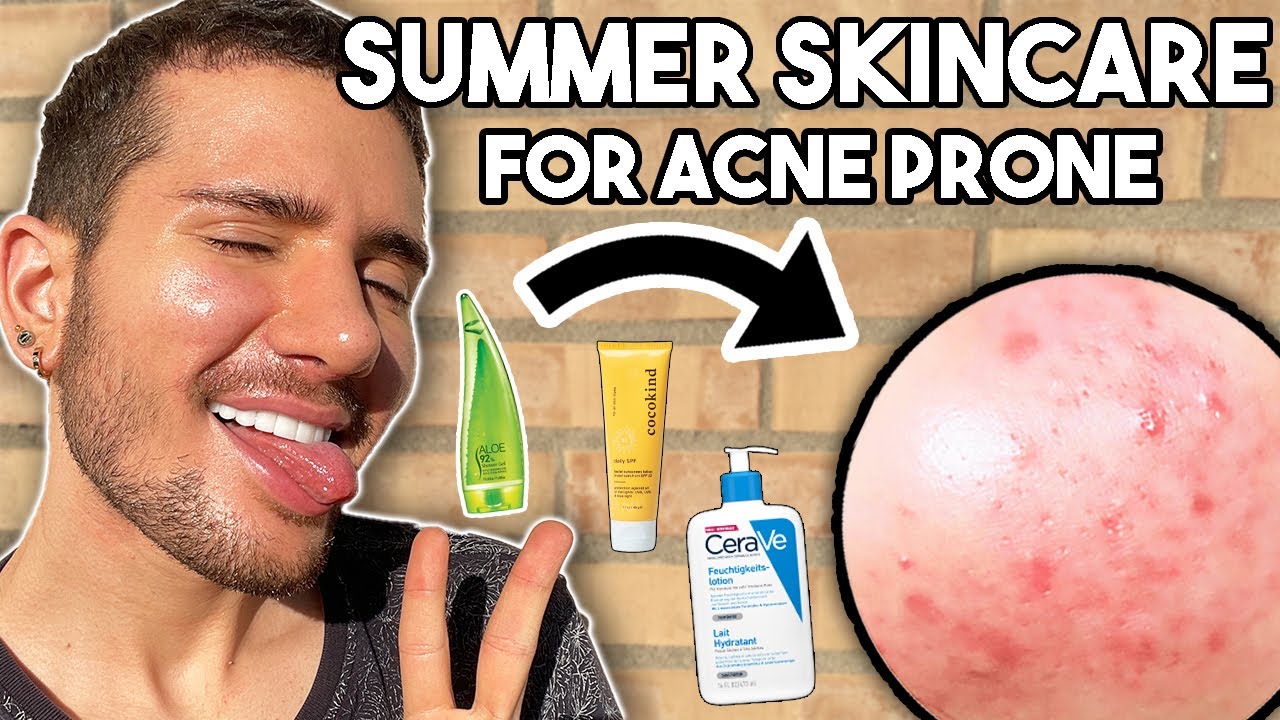 EASY SUMMER SKINCARE ROUTINE FOR ACNE PRONE SKIN!☀️🌋 || (Best SPFs and Serums)