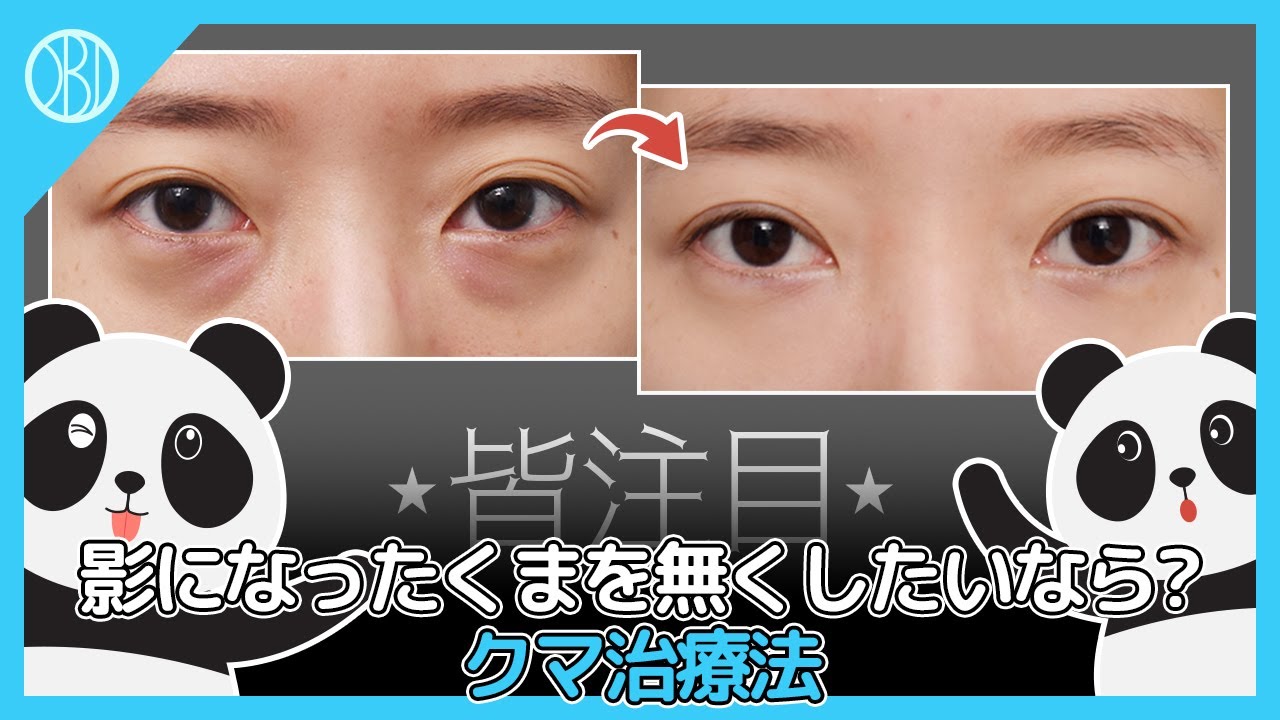 影になったくまを無くしたいなら？皆注目！チャンウク院長が教えてくれるくまの治療法は？