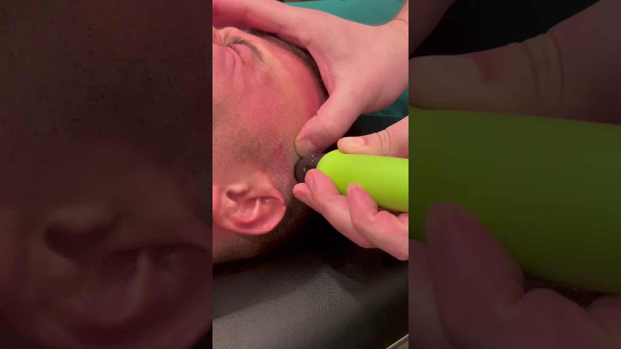 Clench your jaw much? You could have adhesion in your temporalis muscle