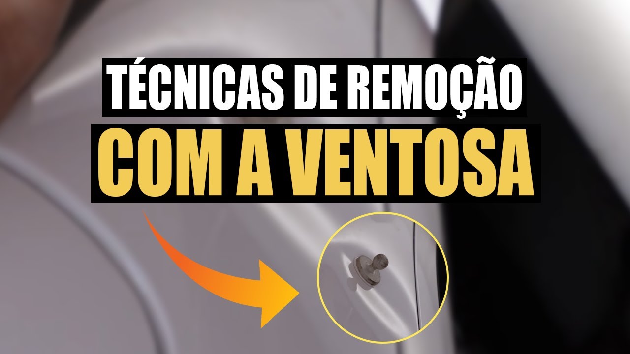 MARTELINHO DE OURO #576 Tecnicas de remocao com a ventosa