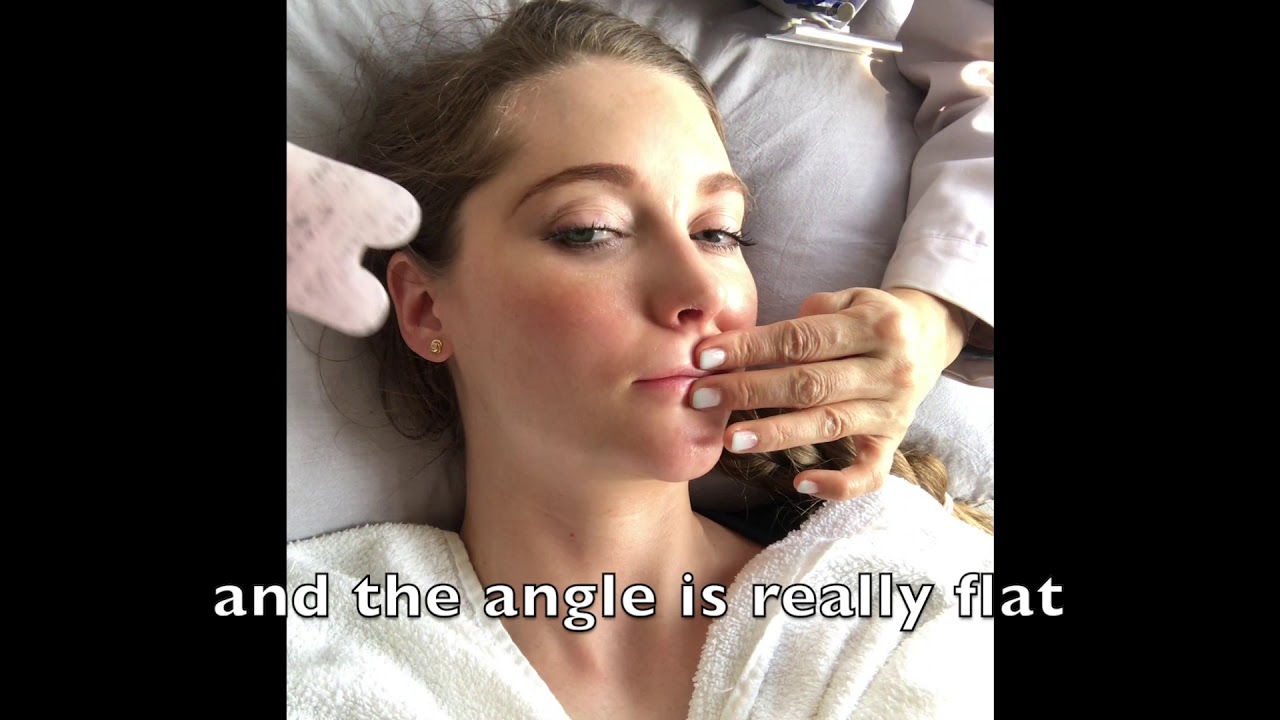Facial Gua Sha (Facial Scraping) by Chinese medicine practitioner
