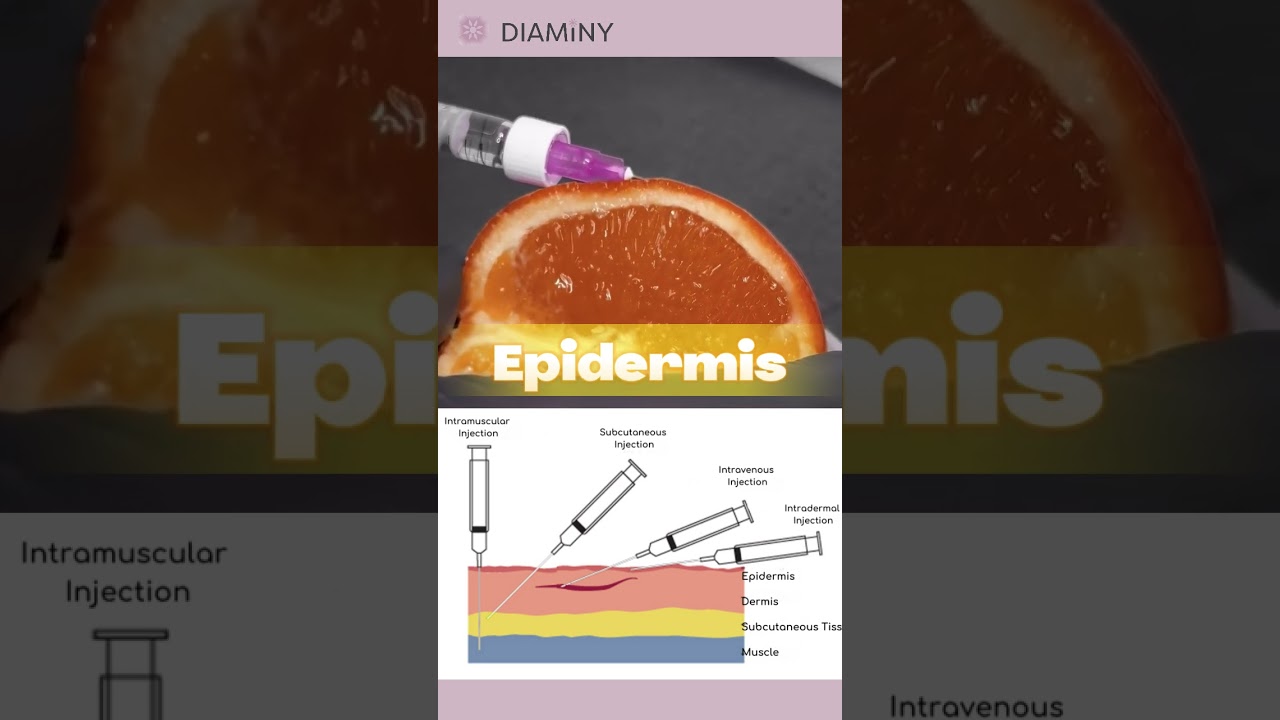 🌟 Injection Angles 101 with Orange Peels! 🍊💉