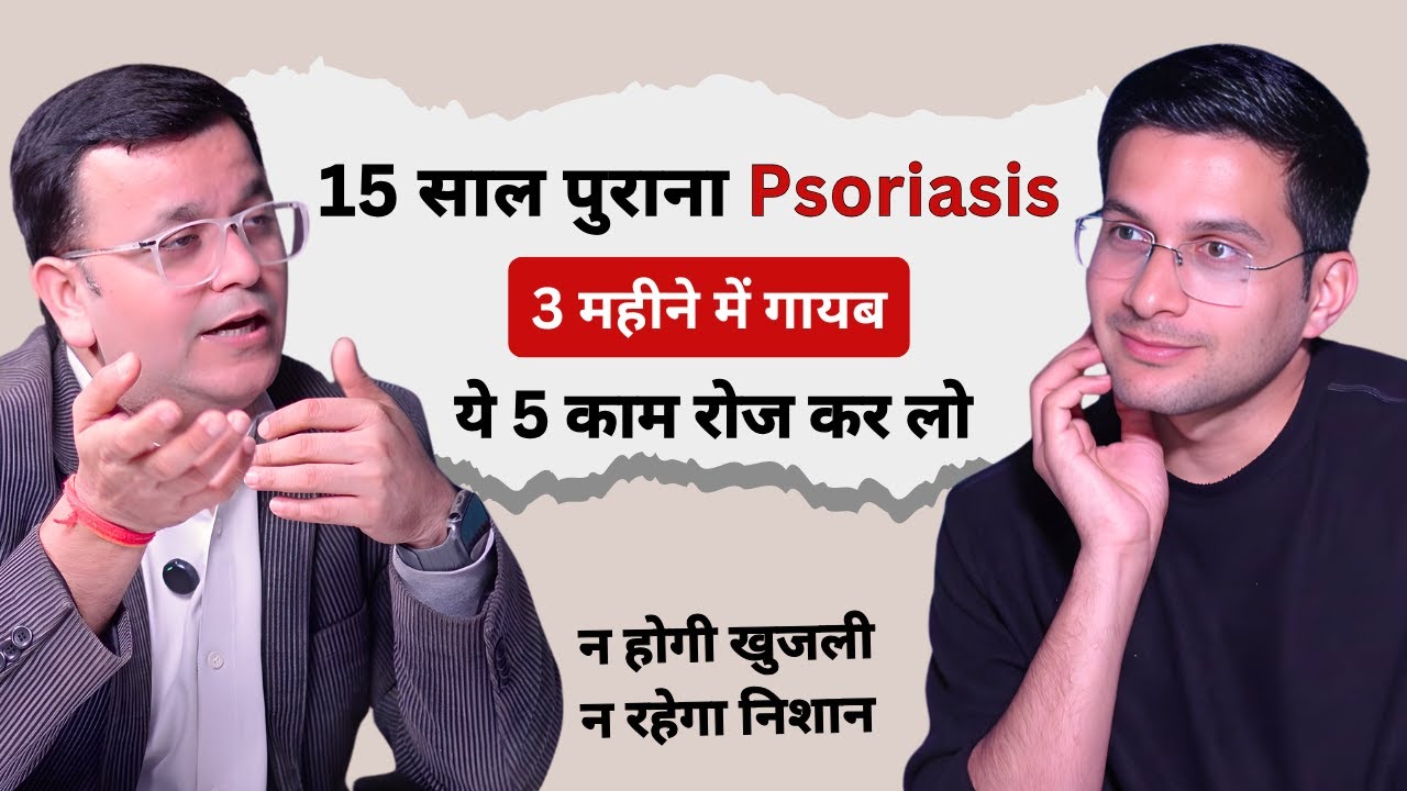 Psoriasis Solution Ft. @Shree Radhey Homeopathy | Himanshu Bhatt