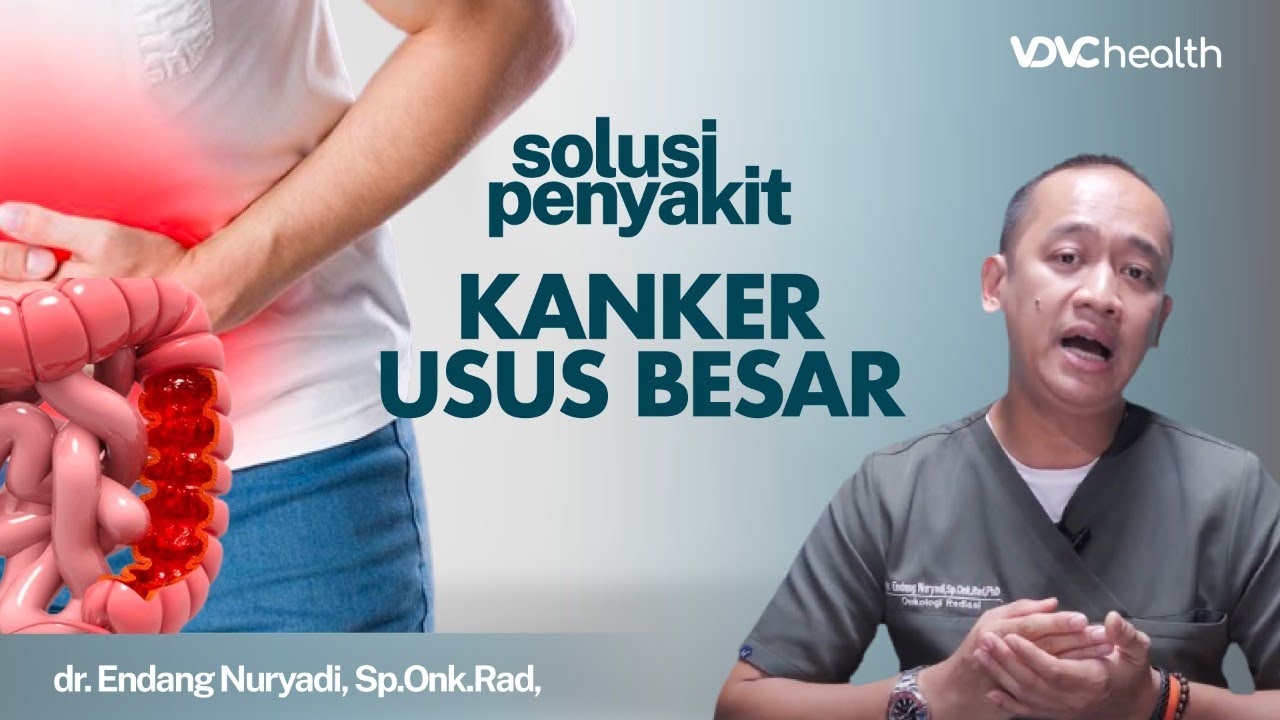 Kanker Usus Besar: Gejala, Penyebab dan Cara Mengatasinya |Kata Dokter #159