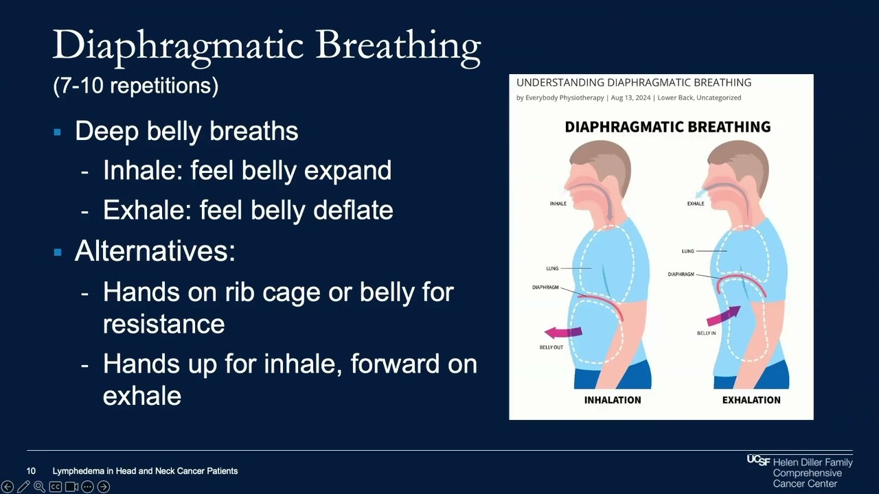 2025 UCSF Head and Neck Cancer Patient Symposium: Lymphedema Management