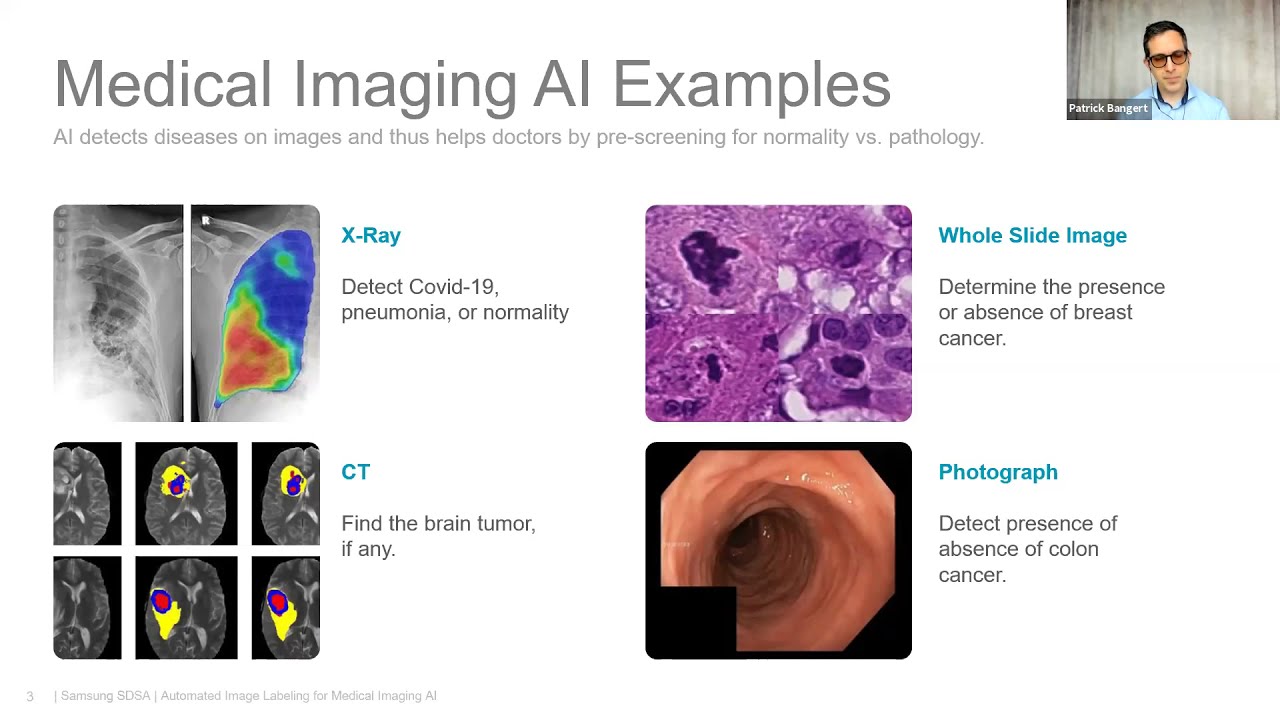 Automated Image Labeling for Medical Imaging AI