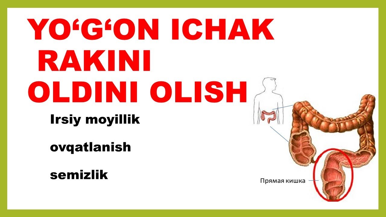 YO‘G‘ON ICHAK RAKINI OLDINI OLISH
