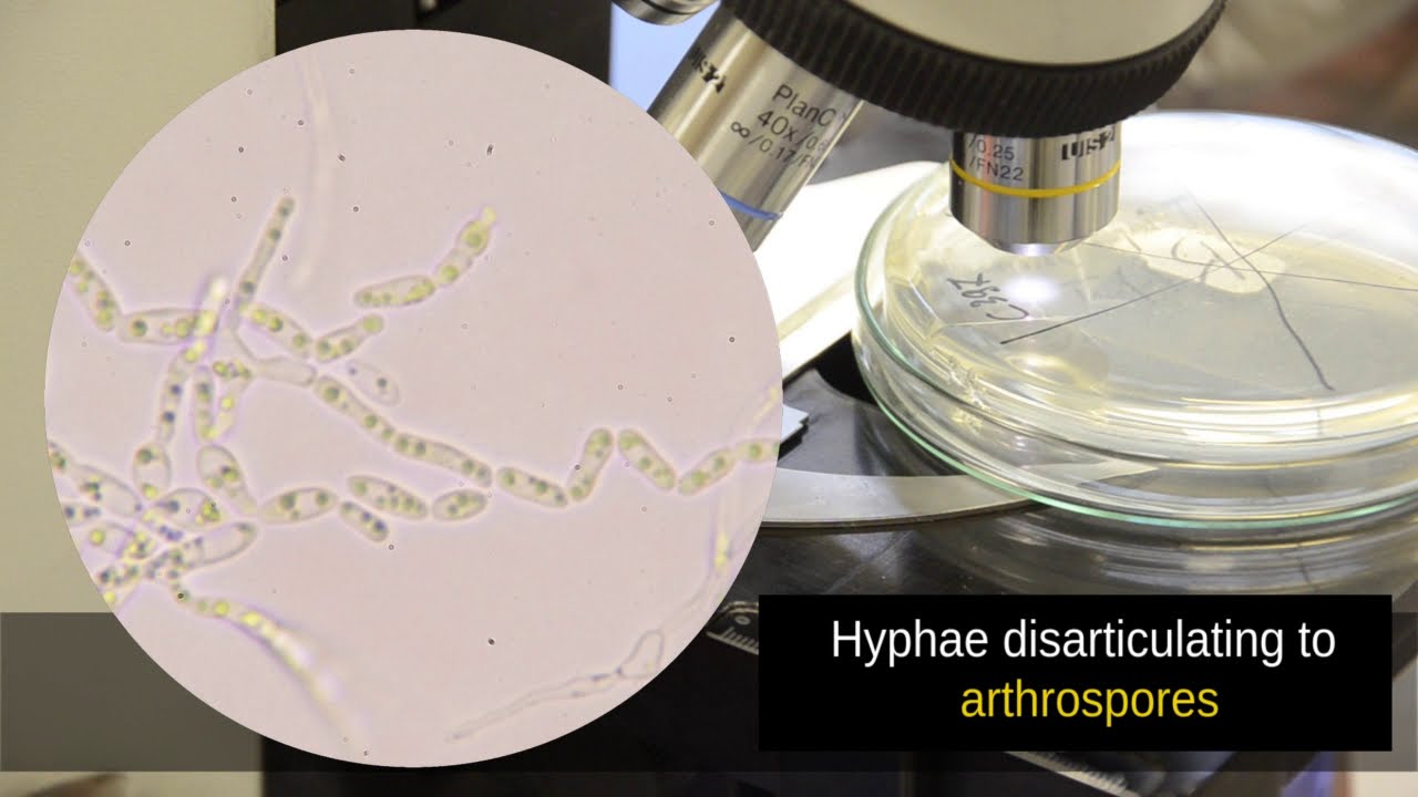 Dalmau Plate Technique - yeast culture on starvation medium