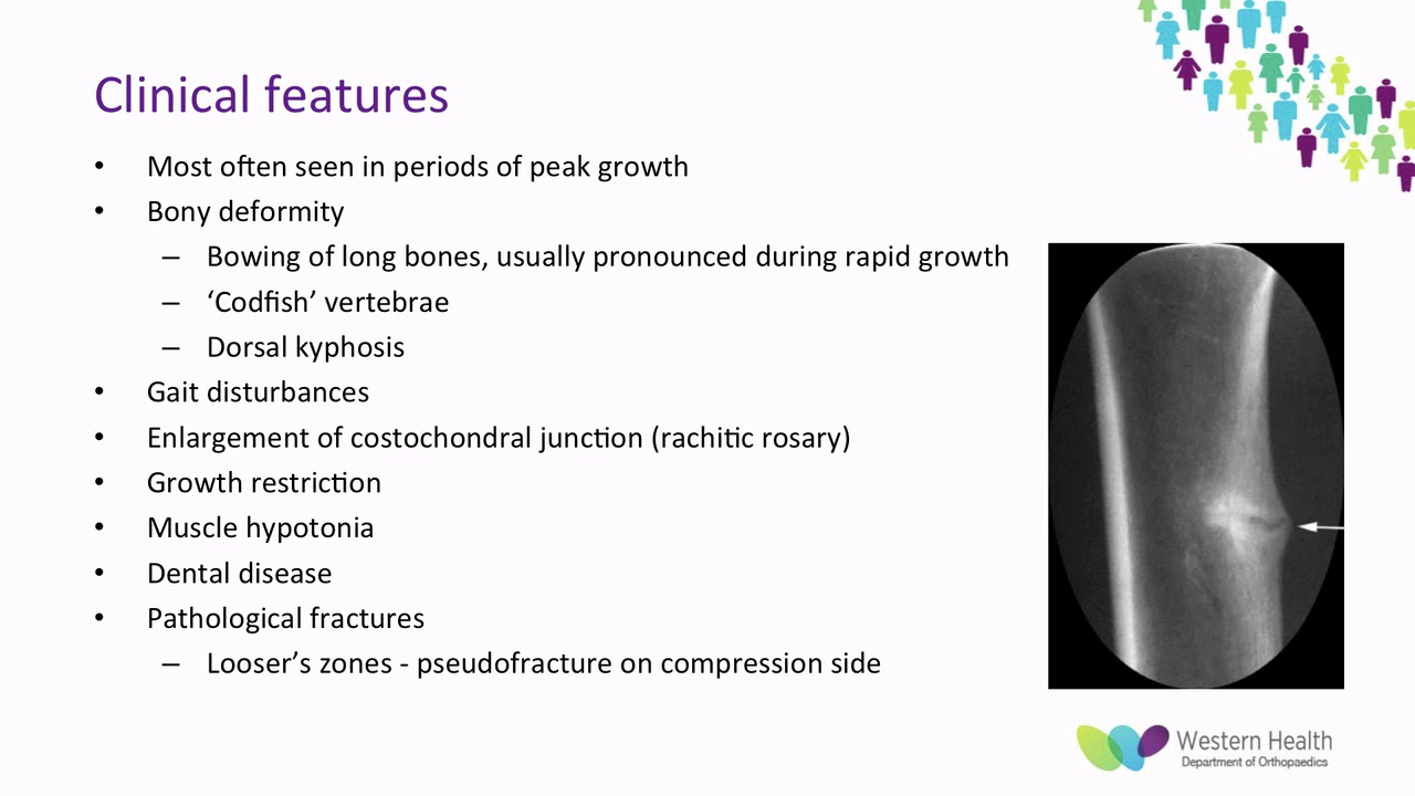 OrthoFracs Rickets Michael Bullen