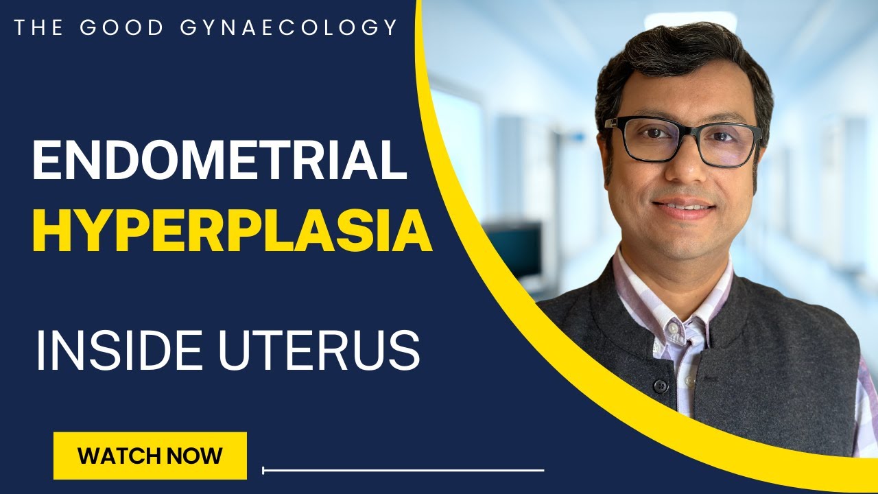 Endometrial Hyperplasia of Uterus | Choosing Right Treatment | Dr Manas Chakrabarti