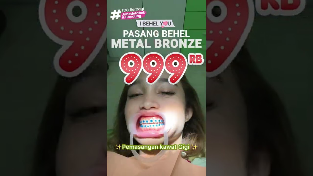 Mau pasang behel? ini jawabannya ✅