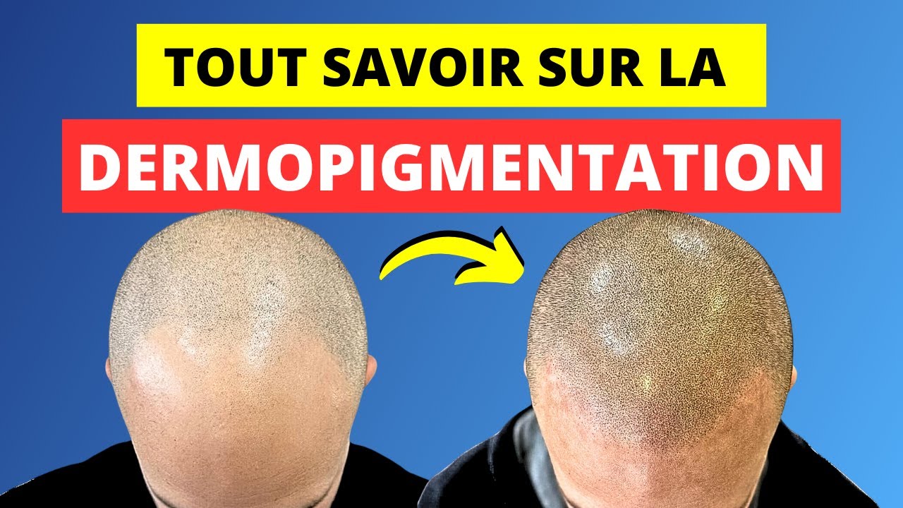 Tout ce que vous IGNOREZ sur la DERMOPIGMENTATION ! 😱 - Expliqué par un Expert!