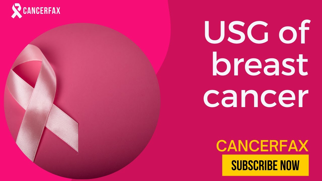 Ultra sound report of breast cancer patient #breastcancer #usg #cancerfax