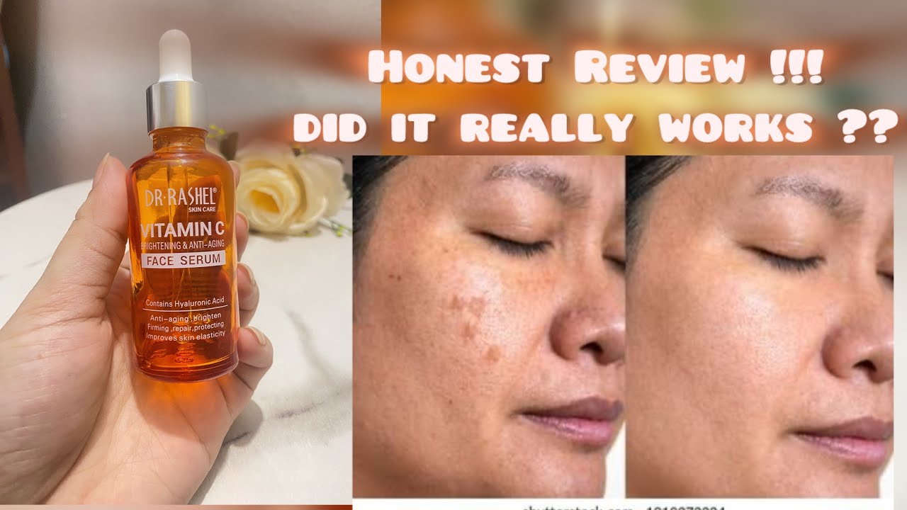 Dr rashel Vitamin C serum Honest Review 🎀✌🏻