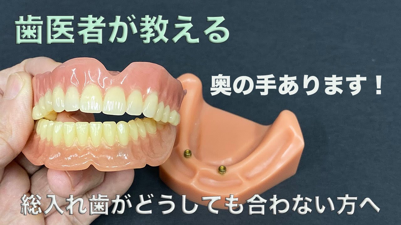 総入れ歯がどうしても合わない方へ・・・奥の手あります。