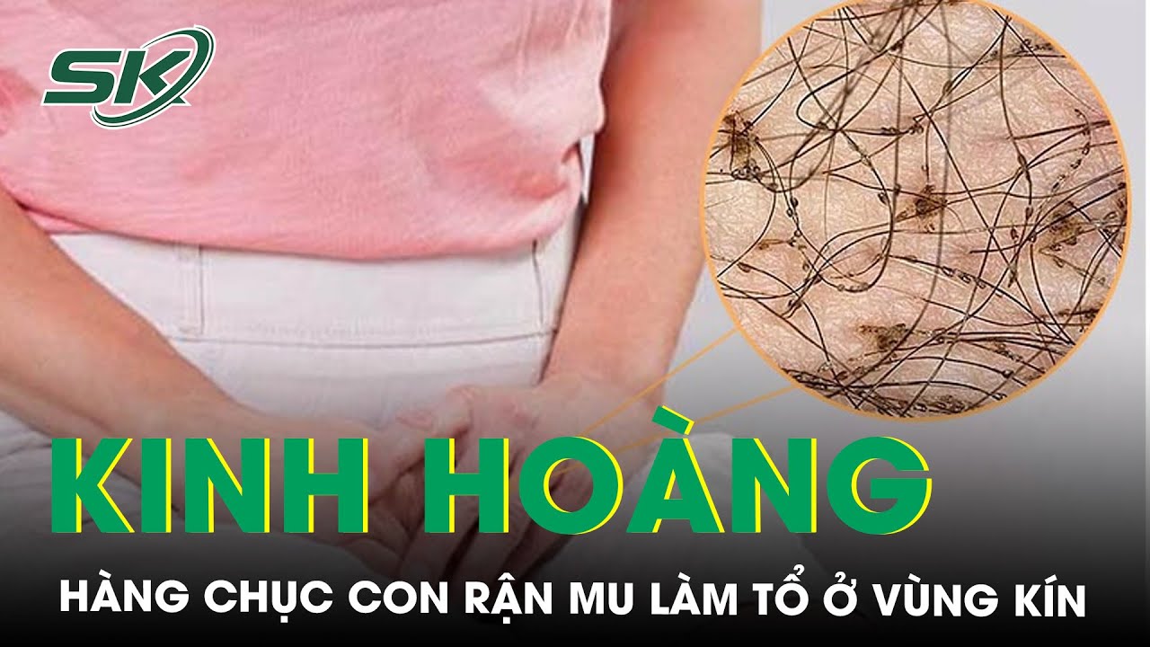 Kinh Ho&agrave;ng H&agrave;ng Chục Con Rận Mu L&agrave;m Tổ Ở V&ugrave;ng K&iacute;n | SKĐS