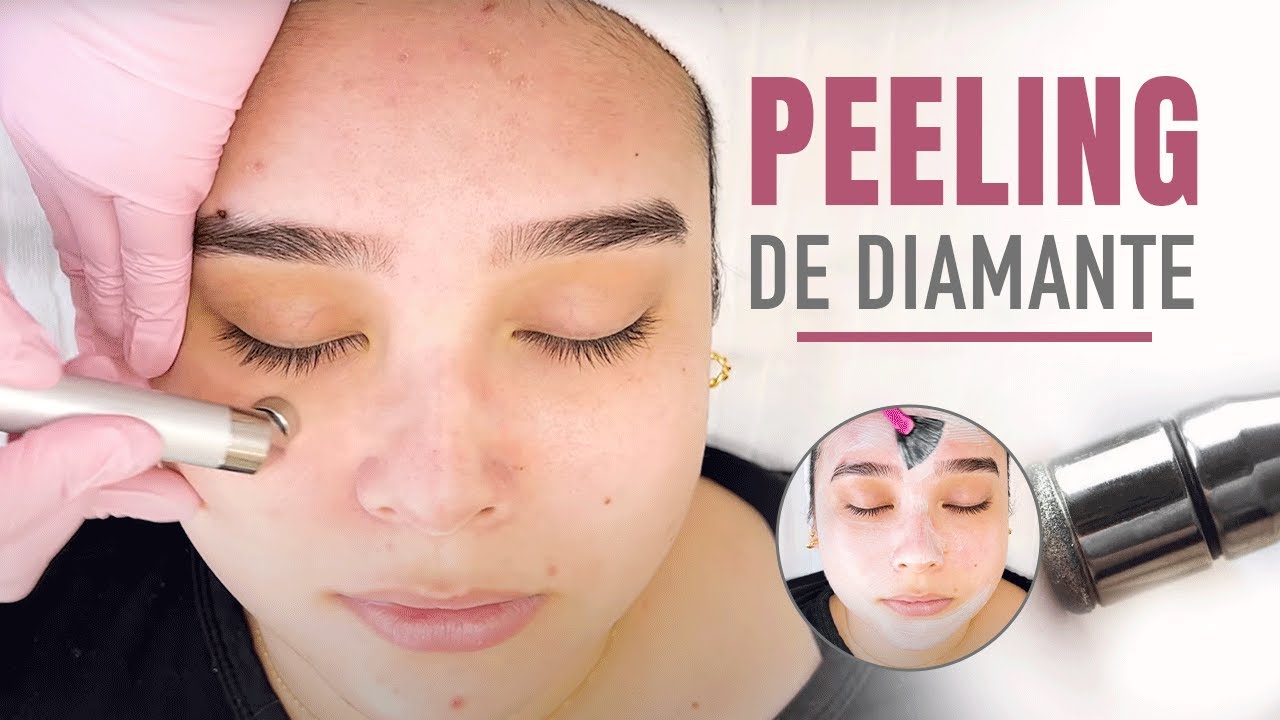 Limpeza de pele com Peeling de Diamante