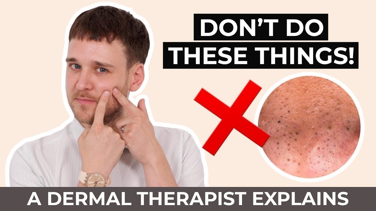 Blackheads Do's and Don'ts