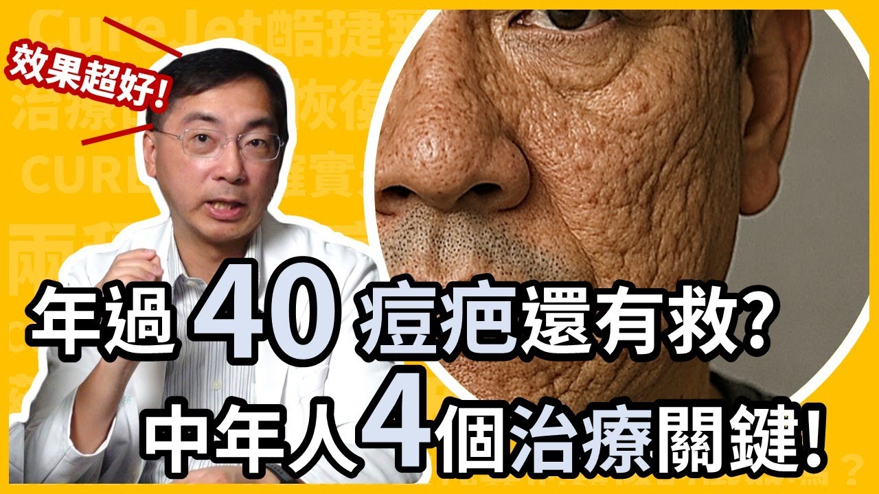 年紀愈大，為何痘疤反而變嚴重？還有救嗎？讓皮膚科醫師告訴你，中年人治療凹痘疤的4個關鍵！