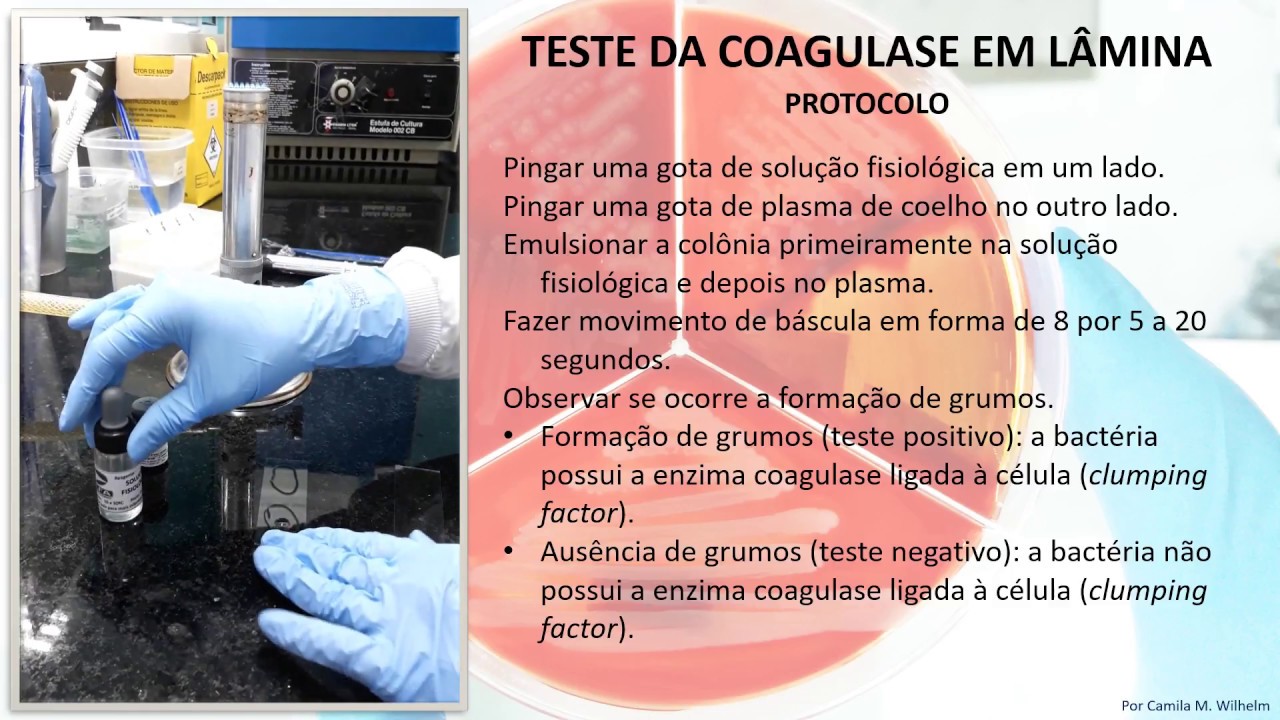 Teste da coagulase em lâmina